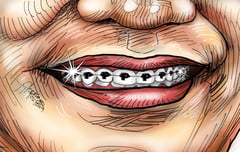 Kiss of death